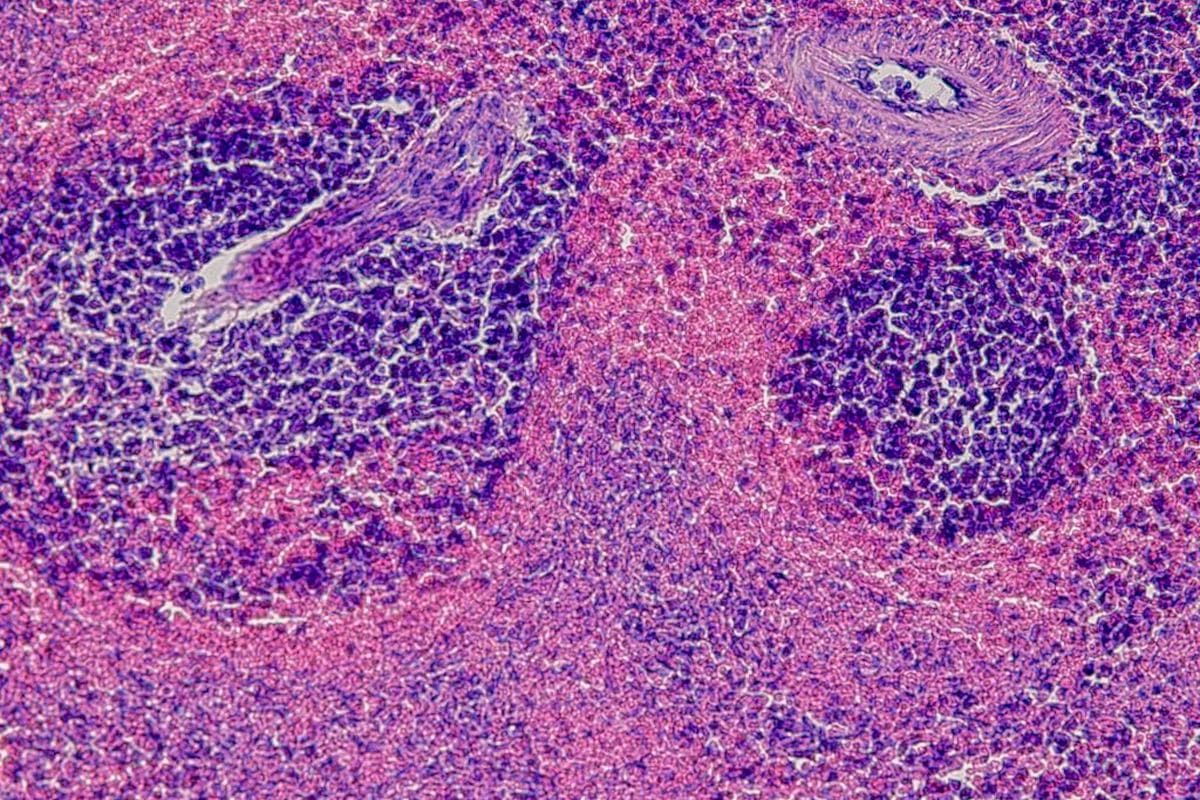 Haematoxylin and eosin stained tissue section under the microscope